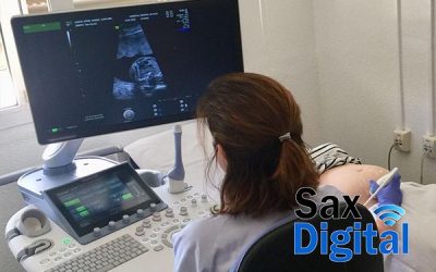 El servicio de Ginecología y Obstetricia del Departamento de Salud de Elda incorpora una nueva prueba que predice la preeclampsia en el embarazo