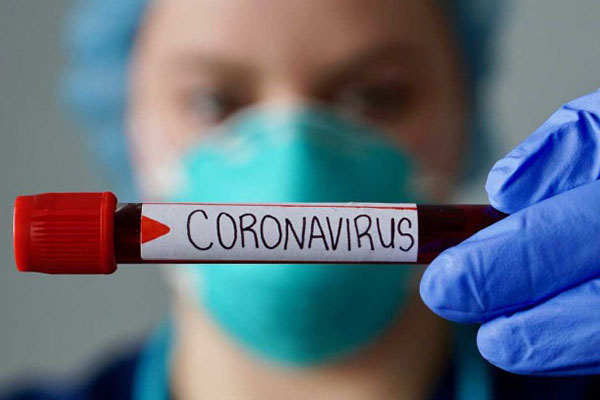 ¿Cómo actuó en casa si estoy contagiado de coronavirus?