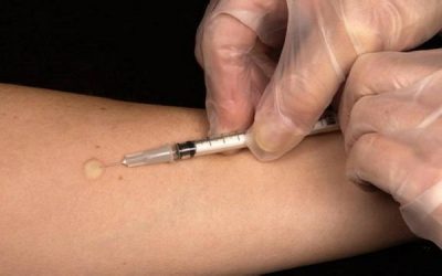 Un 88,7% del total de pacientes con tuberculosis en la Comunitat Valenciana completa con éxito los tratamientos